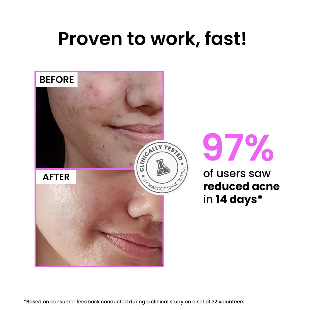 Foxtale 12% Niacinamide Clarifying Serum
